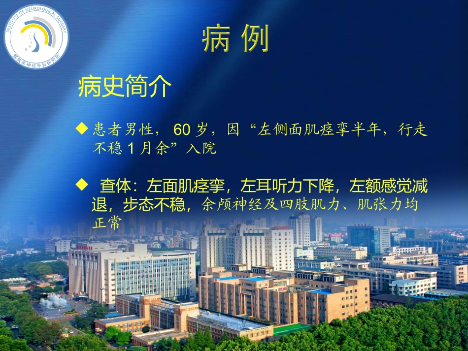 桥小脑角胶质瘤_第2页