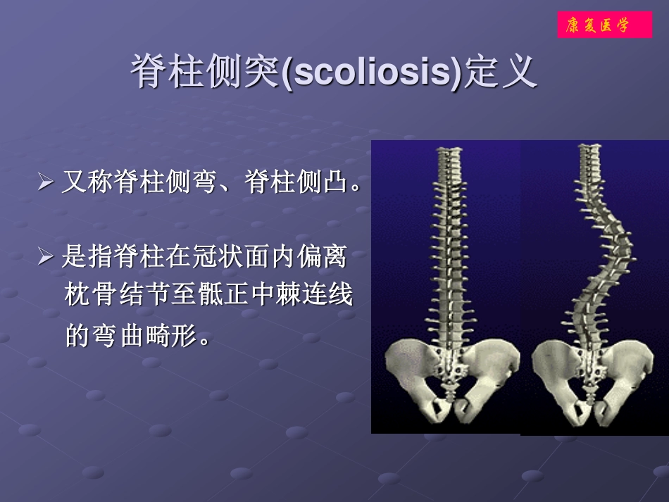 爱爱医资源-脊柱侧弯体操治疗-河北医科大学第三医院康复医学科_第2页