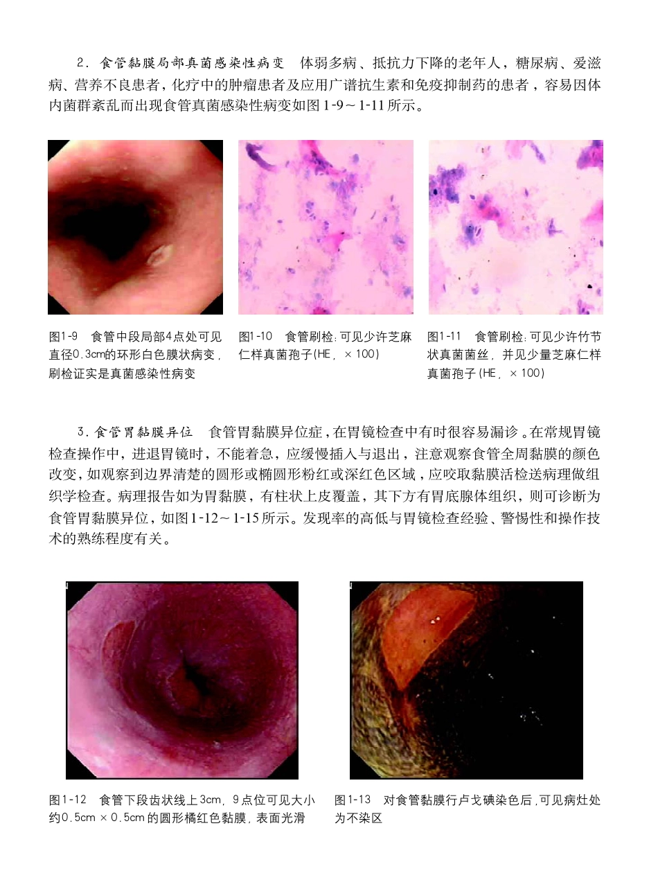 胃镜操作小册子_第2页