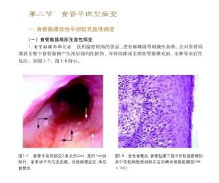 胃镜操作小册子