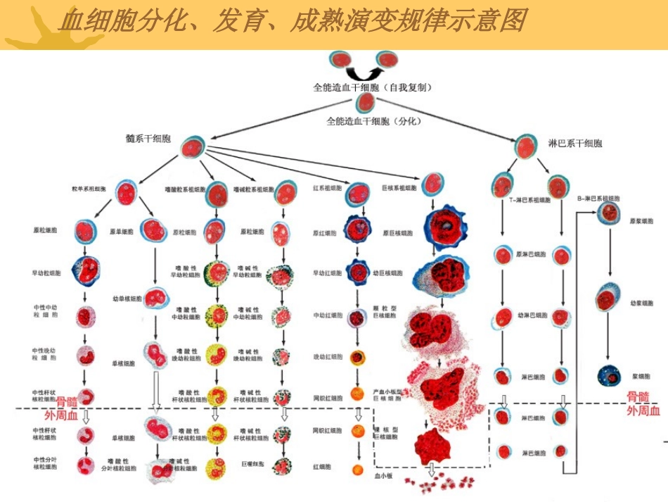 急性白血病-上交_第3页