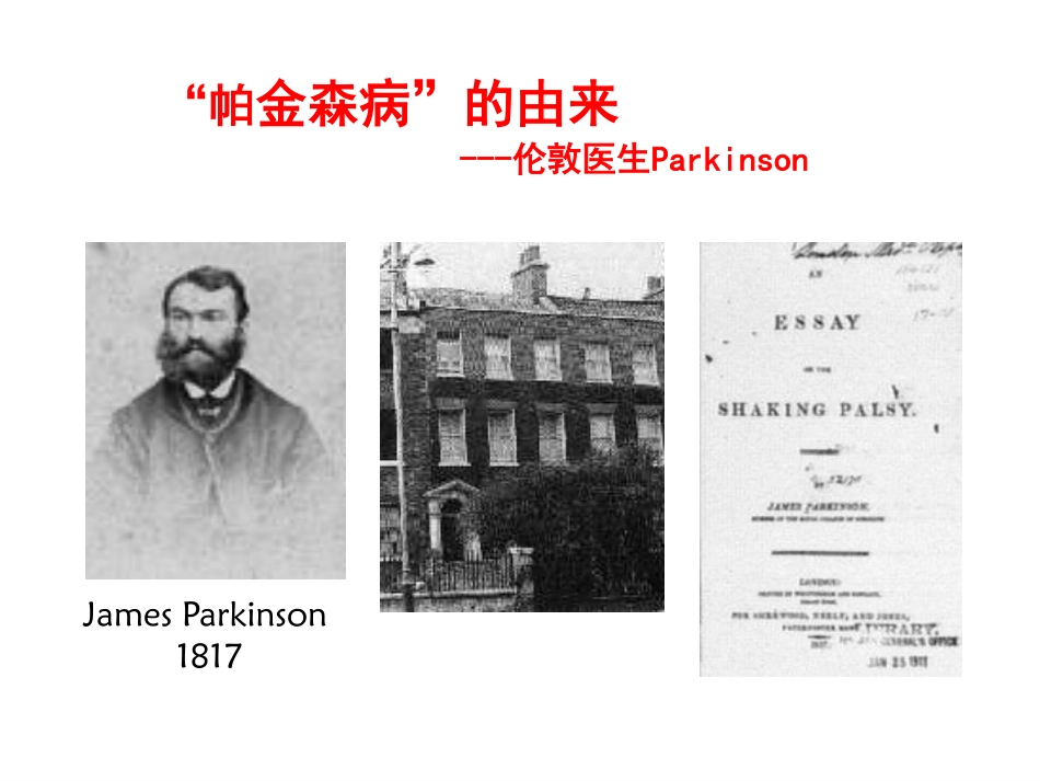 帕金森病诊断标准的演变及解读_第2页