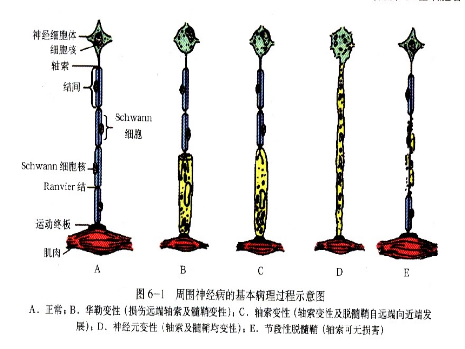 教学课件-周围神经病2_第3页