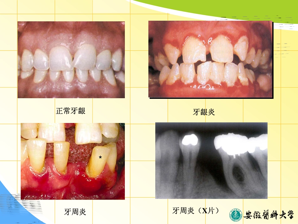 牙周病药物治疗_第3页