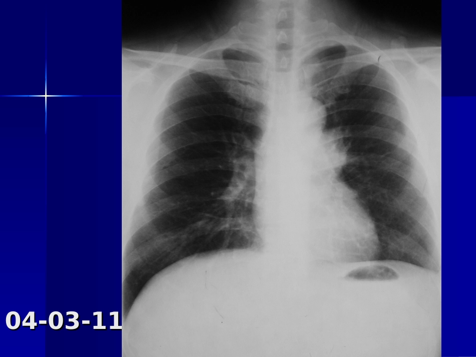 中山病例讨论7_第2页