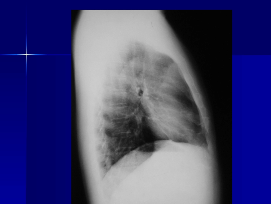 中山病例讨论7_第3页