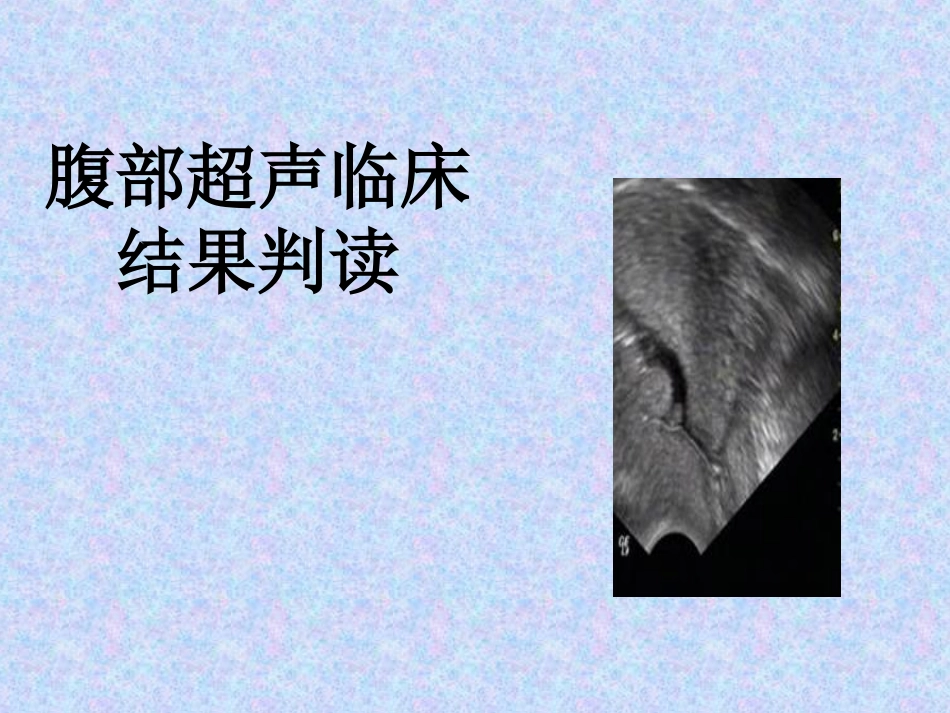 住院医师规培结业-腹部超声判读_第1页