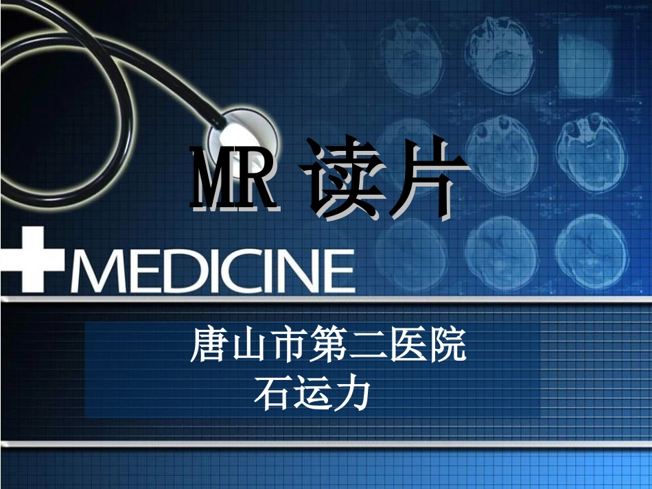 桥小脑角区占位_第1页