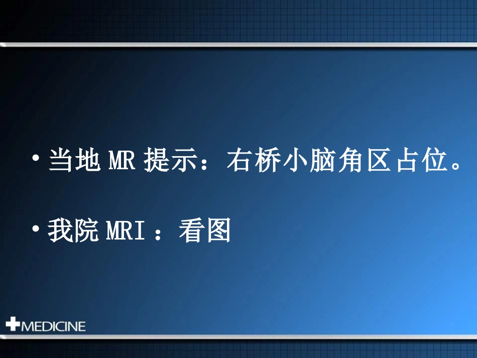 桥小脑角区占位_第3页