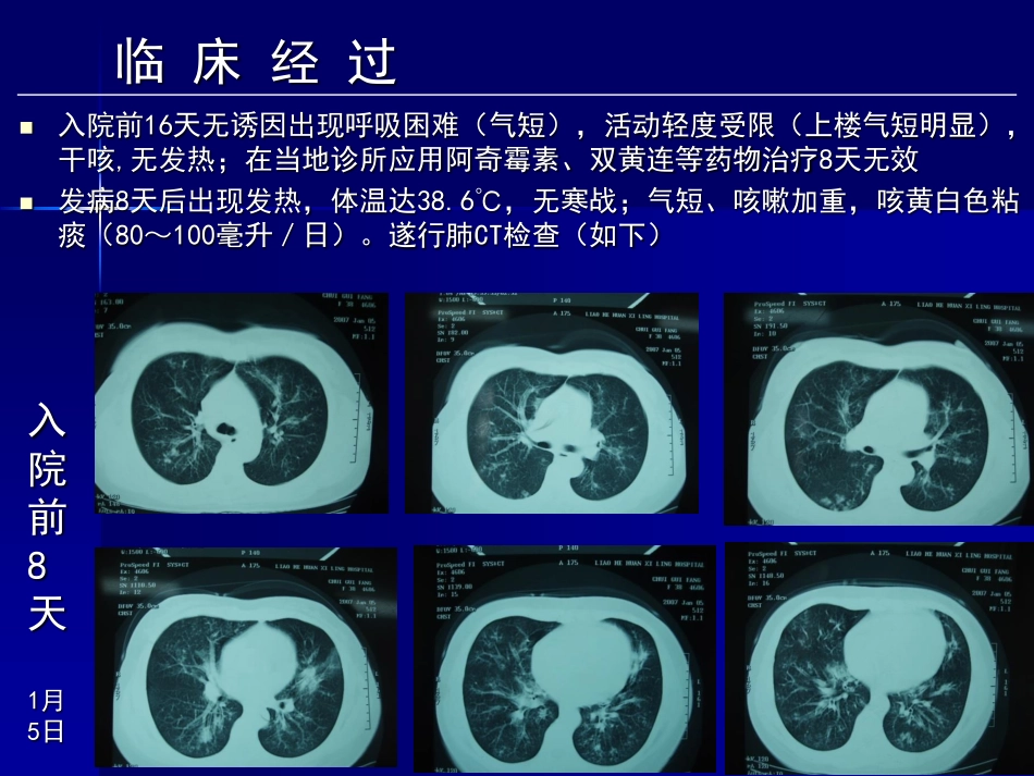陈柏义-肺曲霉的临床多样性_第3页