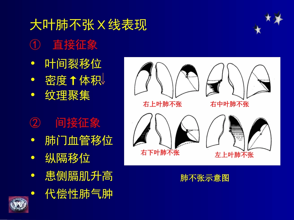 影像学-呼吸基础病变_第2页