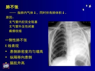 影像学-呼吸基础病变