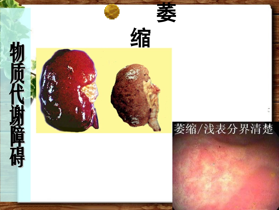 物质代谢障碍及炎症_第3页