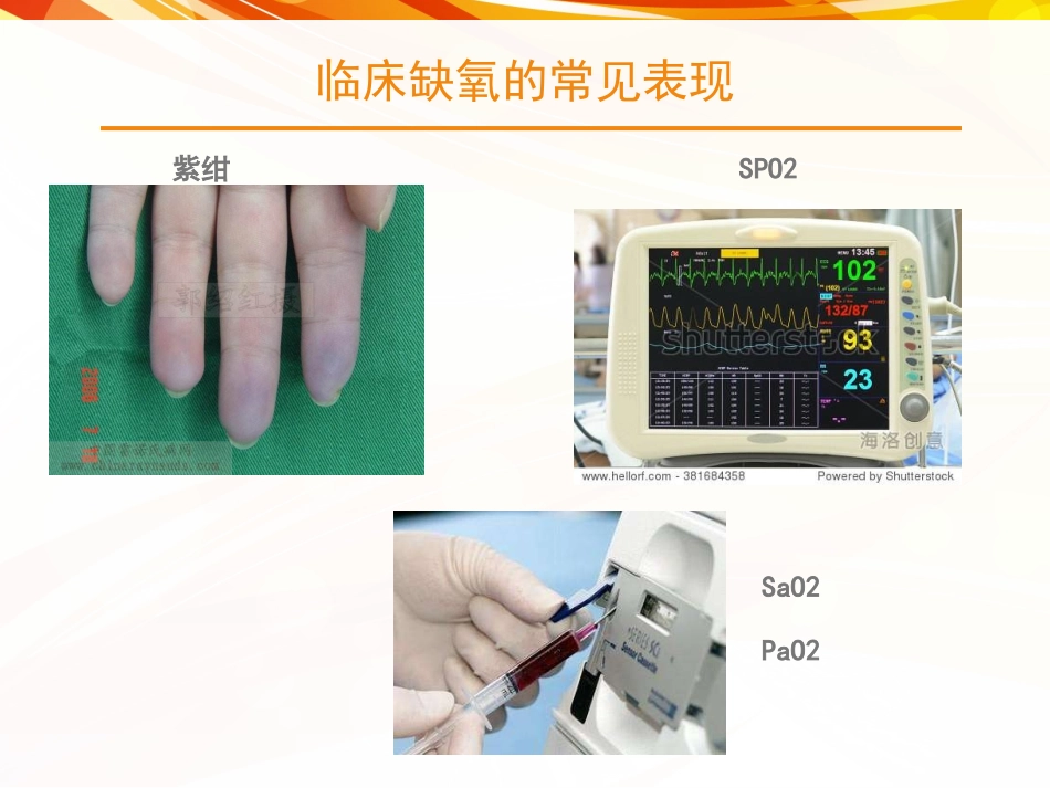 心力衰竭低氧血症_第2页