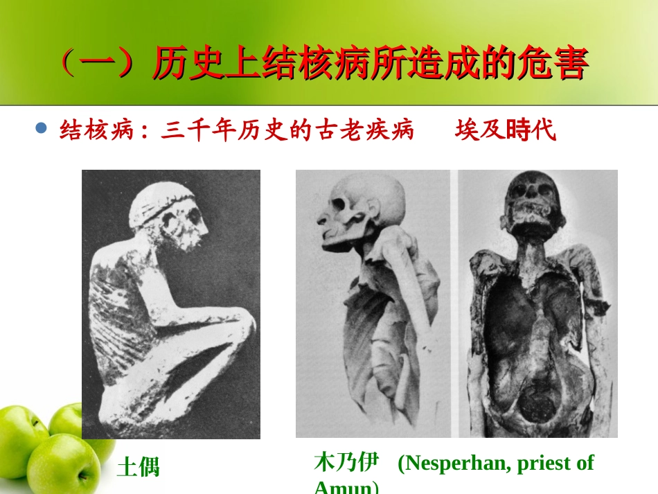 构建无结核病的和谐校园_第2页