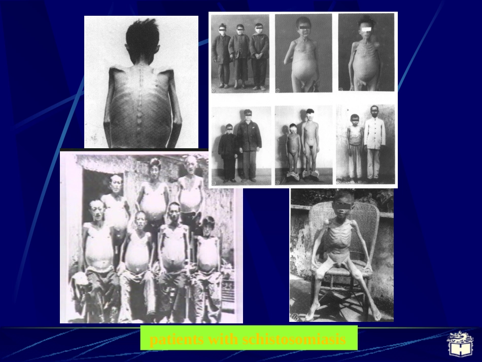 传染病学日本血吸虫病(1)_第2页