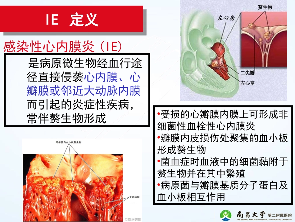 2015ESC-感染性心内膜炎指南_第2页