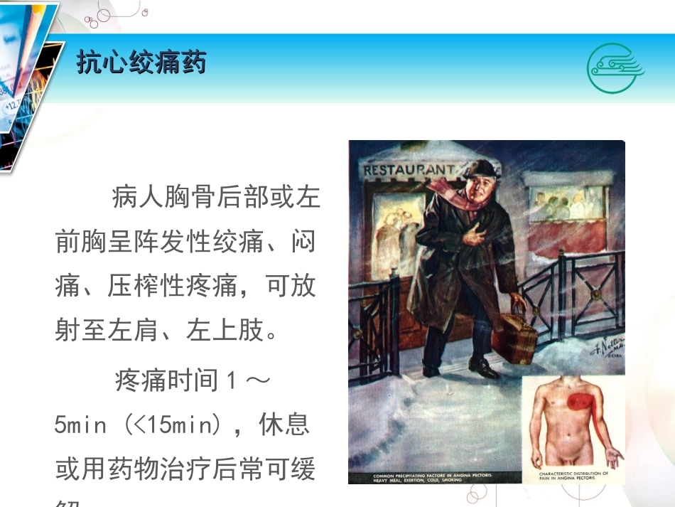 抗心绞痛药及抗动脉粥样硬化药_第3页