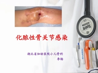 化脓性关节炎查房