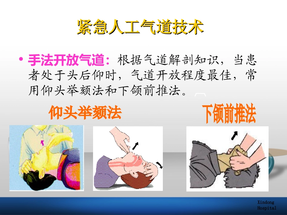 杜-气管插管术_第3页
