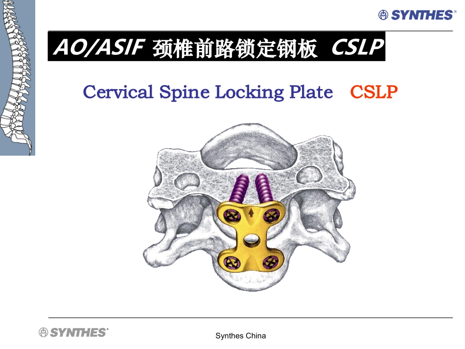 颈椎前路锁定钢板  CSLP-NA-SS_第1页