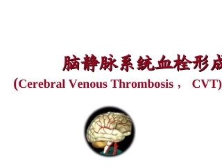脑静脉系统血栓形成.PPT