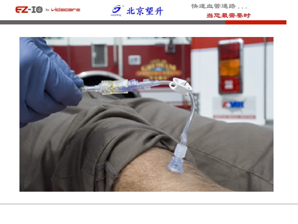 骨髓腔幻灯片_第3页