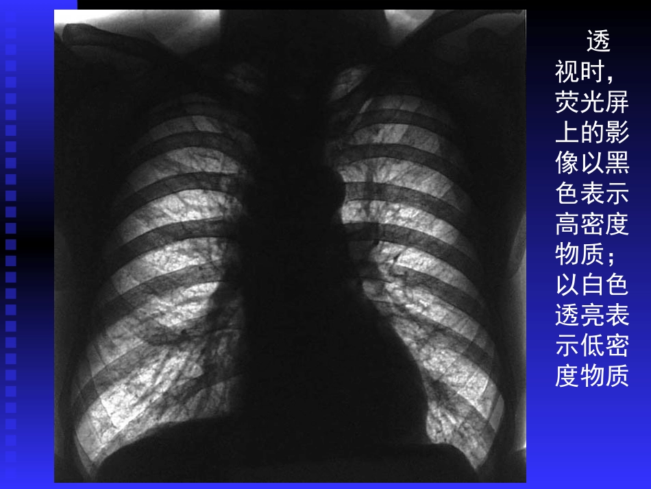 正常胸部影像学PPT_第3页