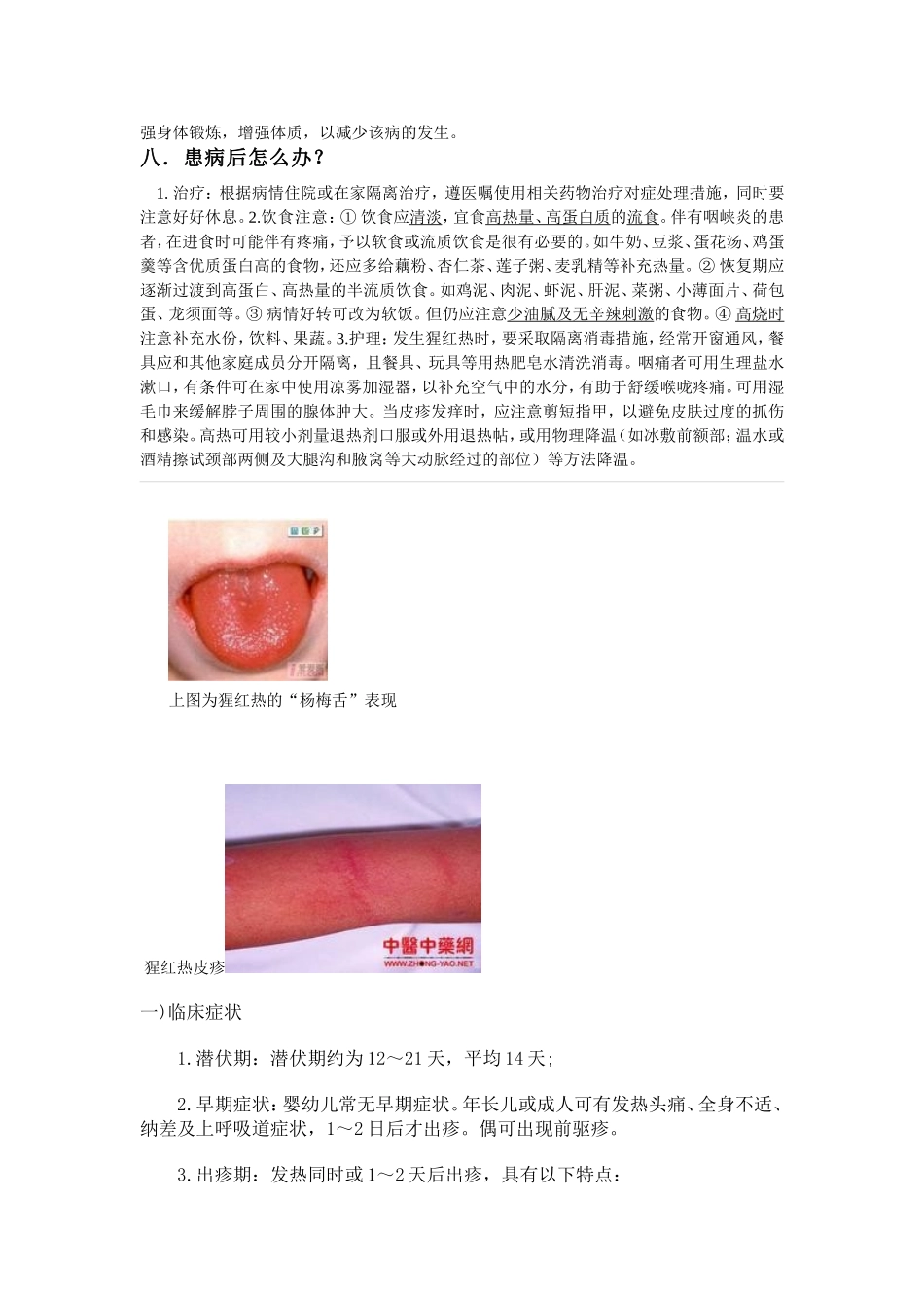 水痘基本知识宣传教育资料（广播稿）_第2页