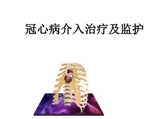 冠状动脉介入