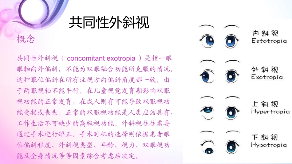 斜视教学查房_第2页