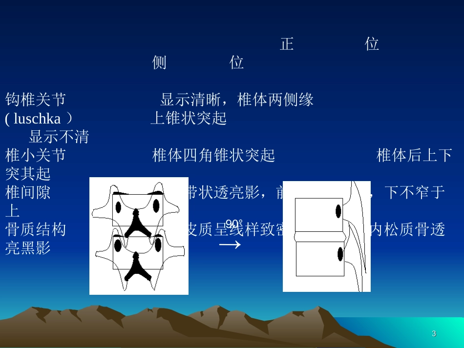 脊柱X线解剖_第3页