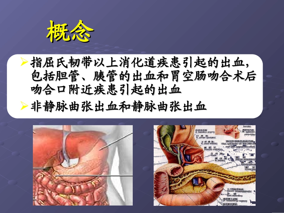 朱峰-上消化道出血的诊治基础和进展_第2页