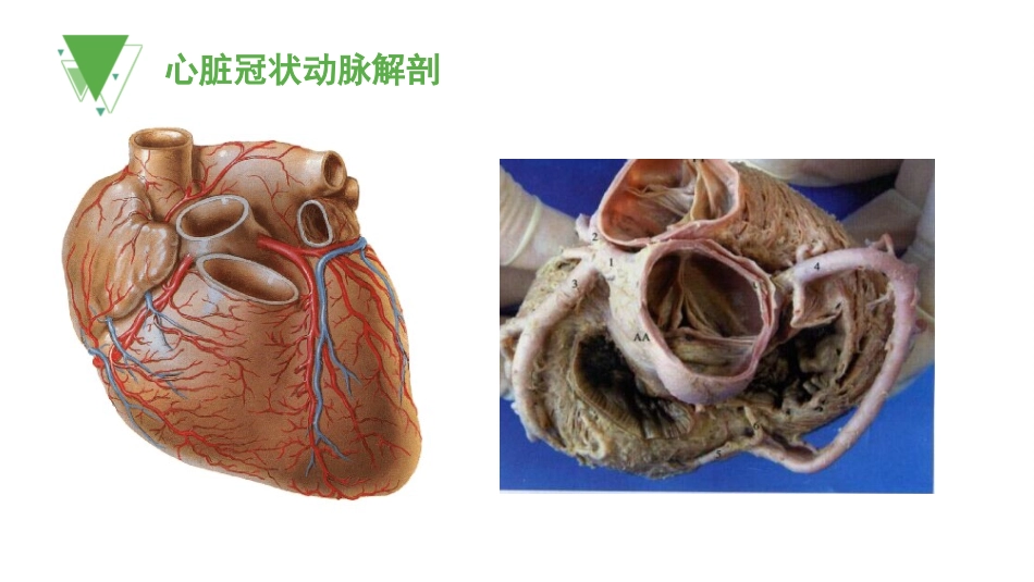 心脏冠脉CTA_第3页