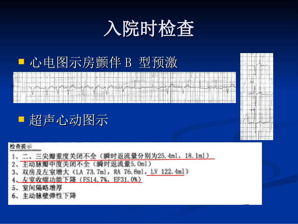 心动过速性心肌病_第3页