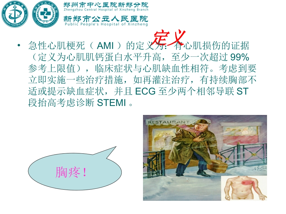 急性ST段抬高型心肌梗死-2017指南_第2页
