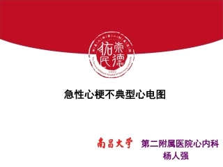 急性心肌梗死不典型心电图