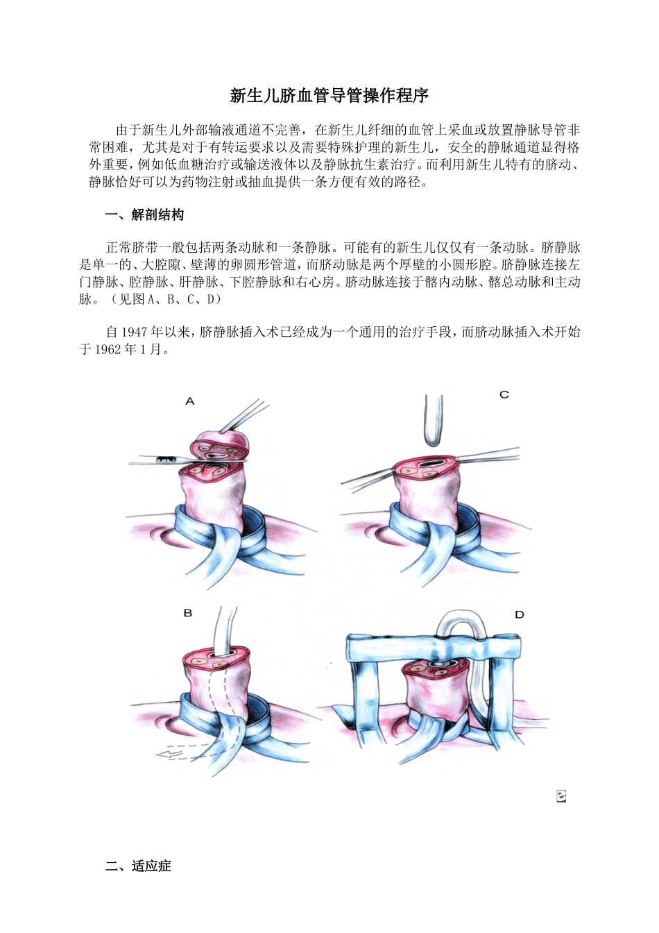 新生儿脐血管插管操作手册_第1页