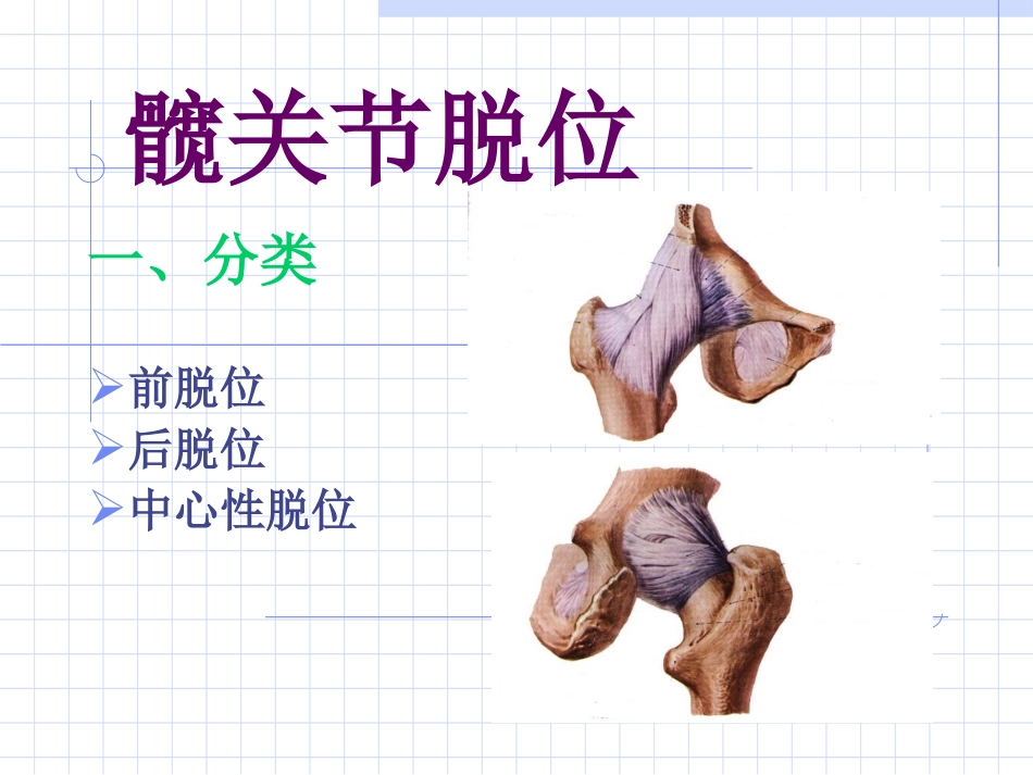 下肢骨与关节损伤2011_第3页