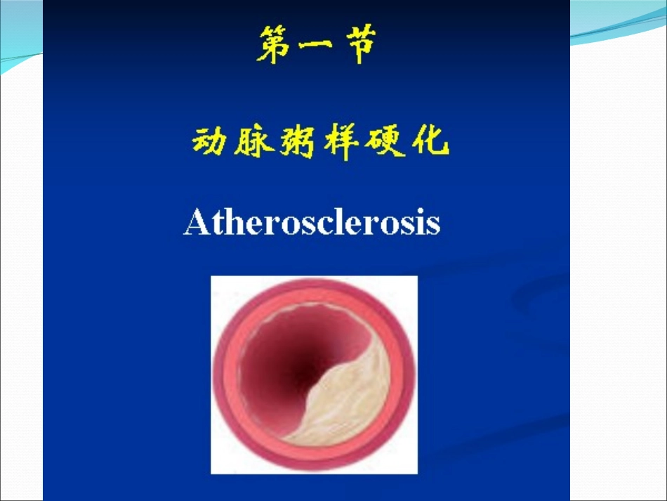 动脉粥样硬化和高血压_第3页