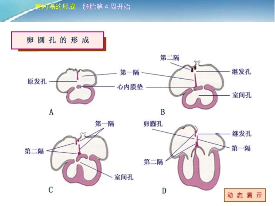 儿童先天性心脏病_第3页