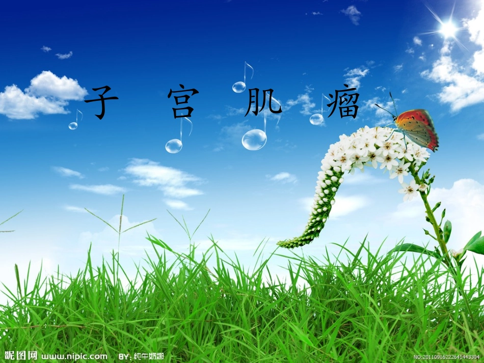 子宫肌瘤的诊治_第1页