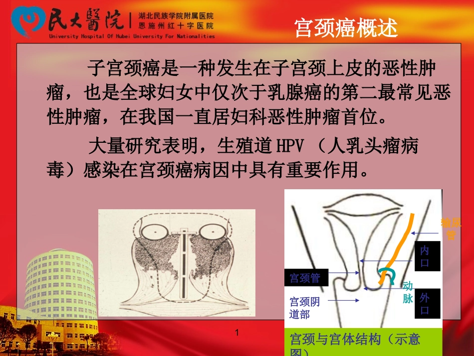 宫颈癌放化疗后不良反应及相关处理--熊_第3页