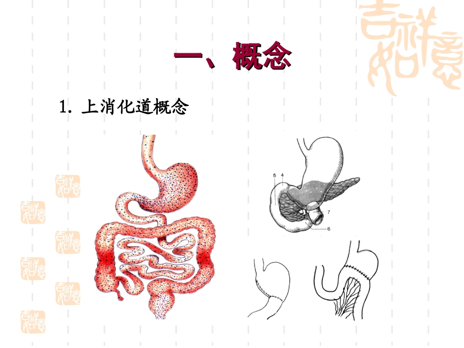 xxxttt上消化道出血_第3页