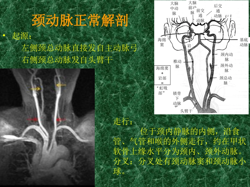 头颈部血管解剖_第3页