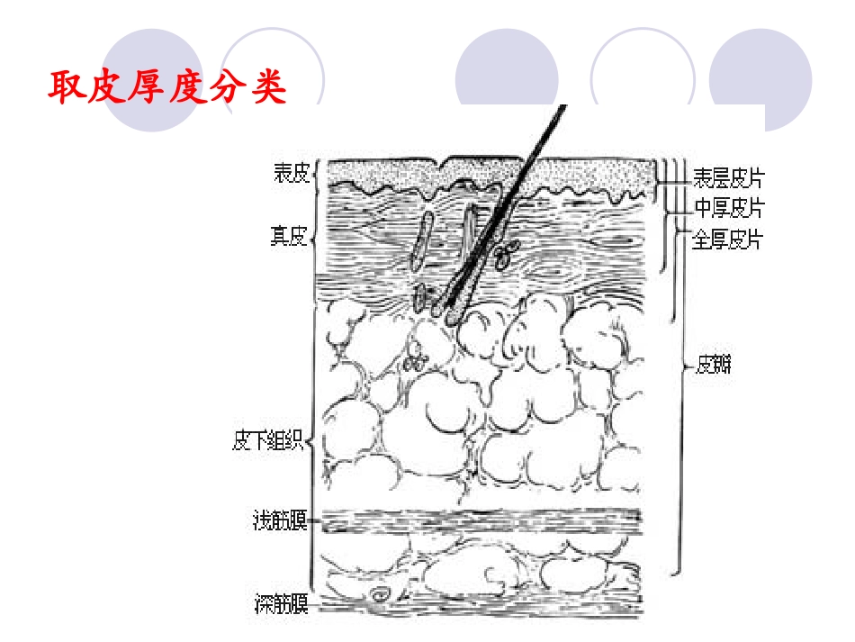 烧伤供皮区创面应用_第2页