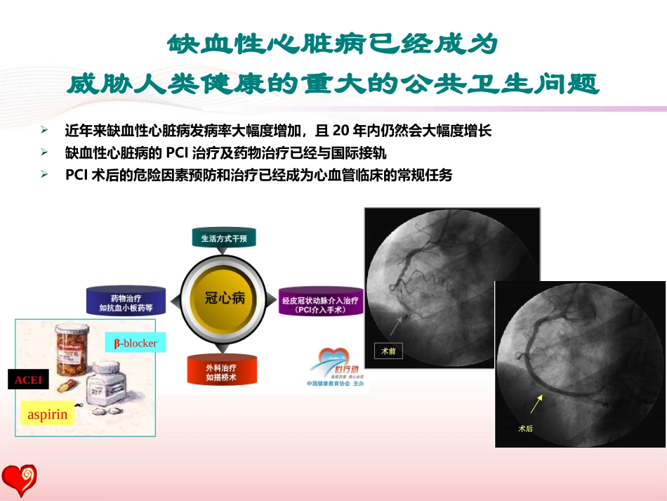 PCI术后患者的心脏康复--指南与现实(2016盛京会)_第3页