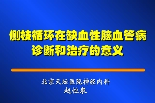 脑血管病与侧枝循环