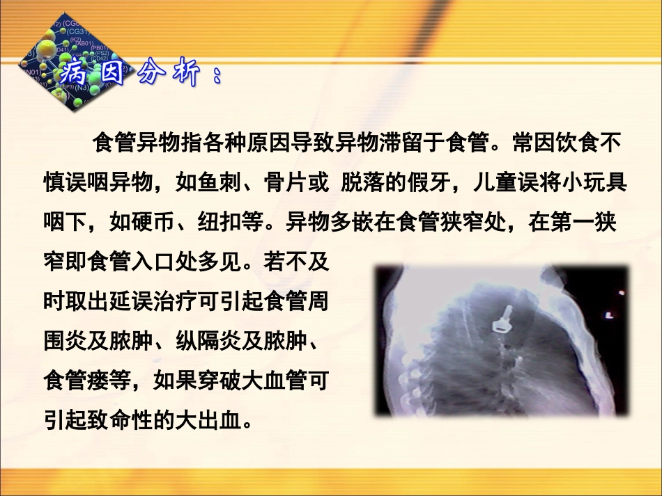 食道异物护理课件_第2页