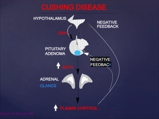 库欣综合征专家共识自创